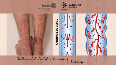 Dia Nacional de Combate e Prevenção à Trombose