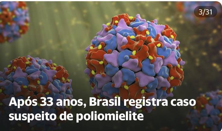 Vírus da poliomielites 