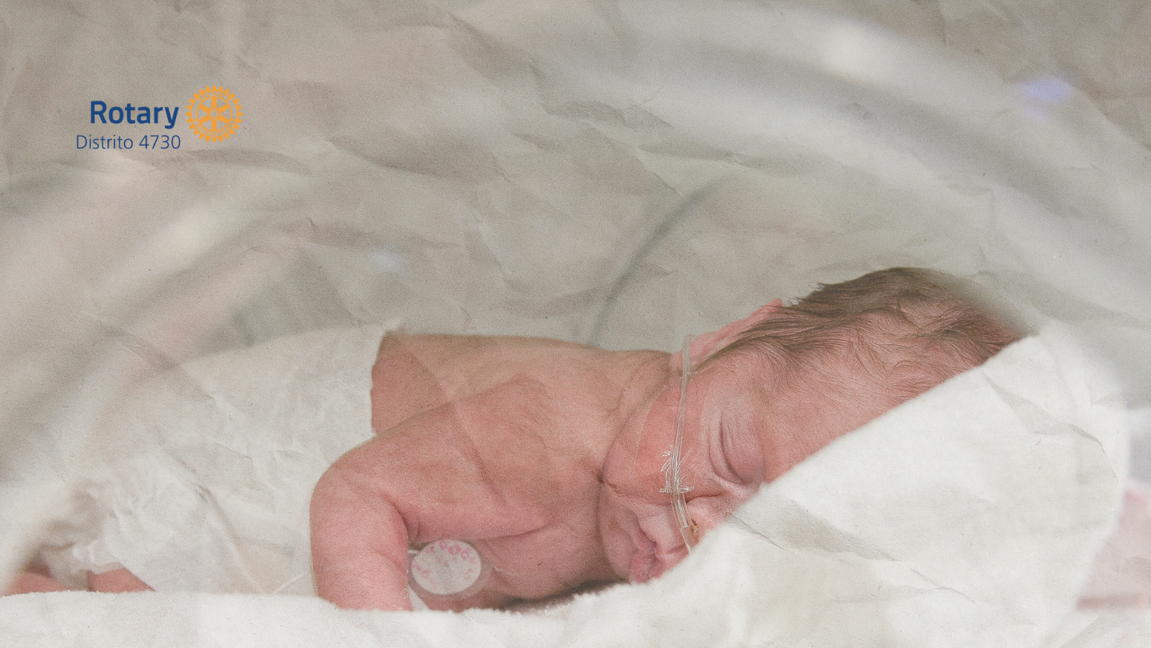 Quase três mil bebês foram internados com sintomas de desnutrição em 2022