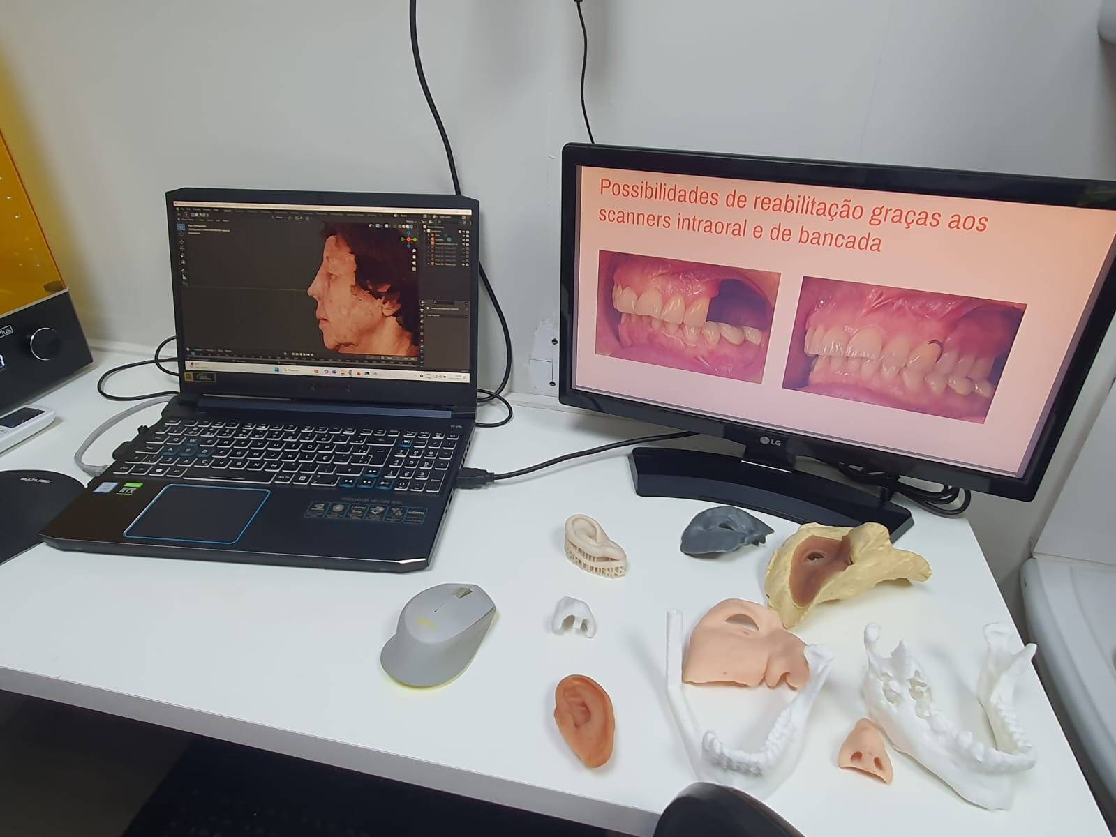  Governador Eder Bocchini e sua Esposa Nelly Visitam Hospital Amaral Carvalho em Jaú e Conhecem o Projeto Faces