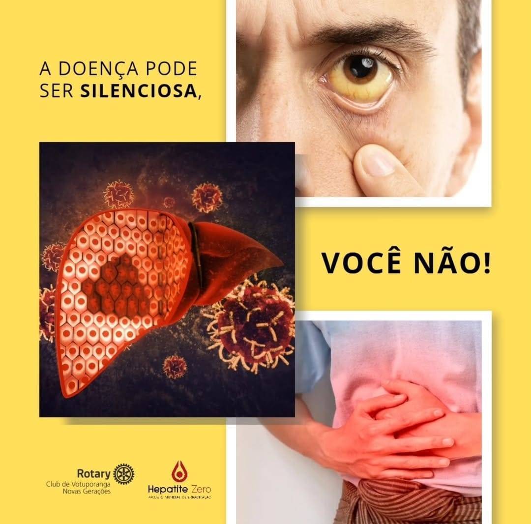 Julho Amarelo: o Rotary Club de Votuporanga - Novas Gerações reforça importância dos exames contra hepatites virais.