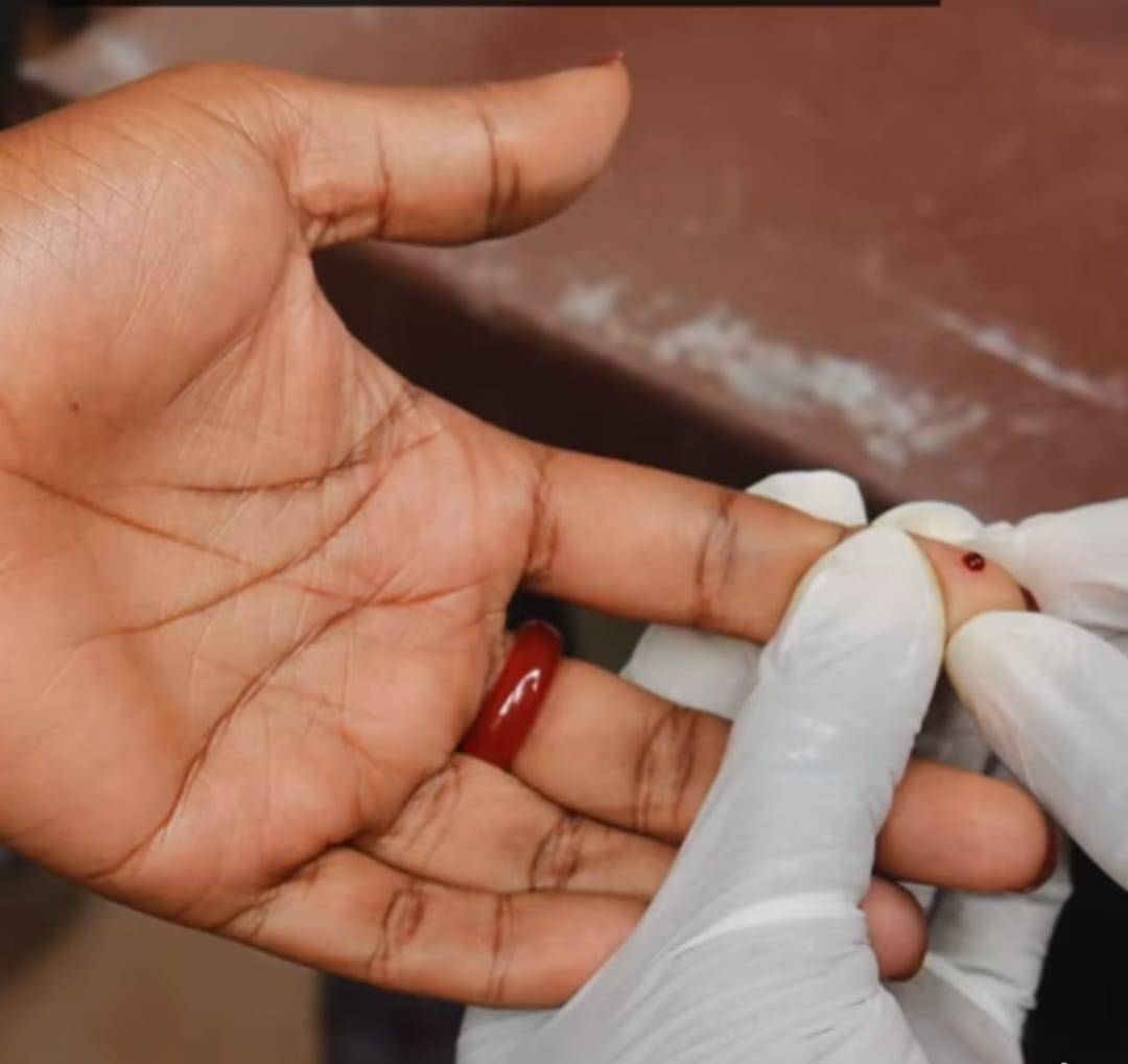 Associados do Rotary ao redor do mundo estão ação para eliminar a hepatite.