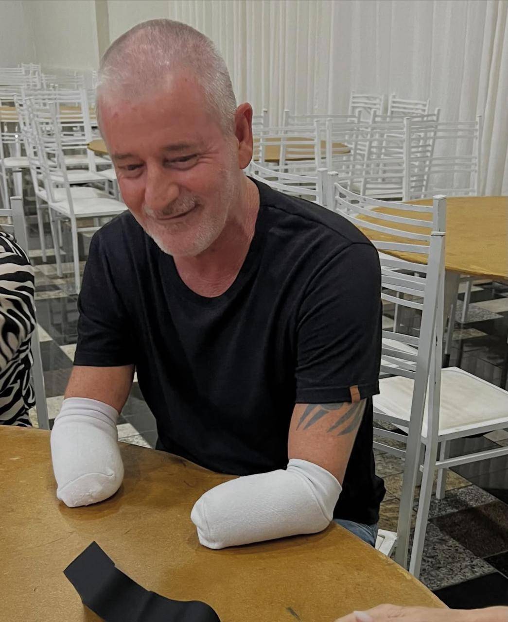 Rotary Devolve Autonomia a Mecanico com Entrega de Protese gratuita