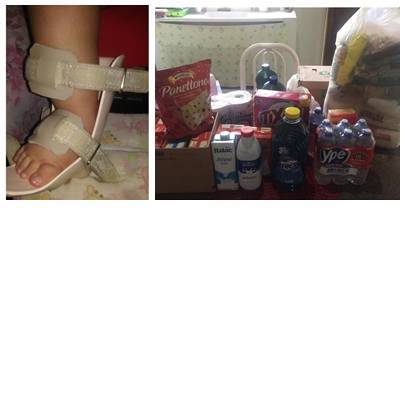 Cesta básica e bota ortopédica entregues.